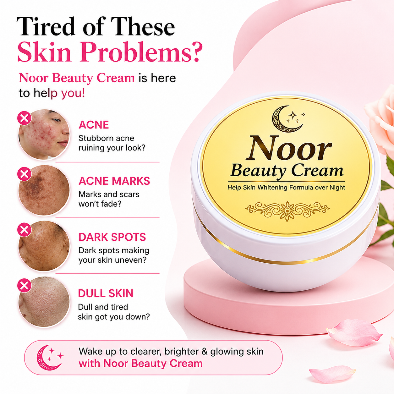 Noor Beauty Cream | Acne Marks & Dark Spots Care