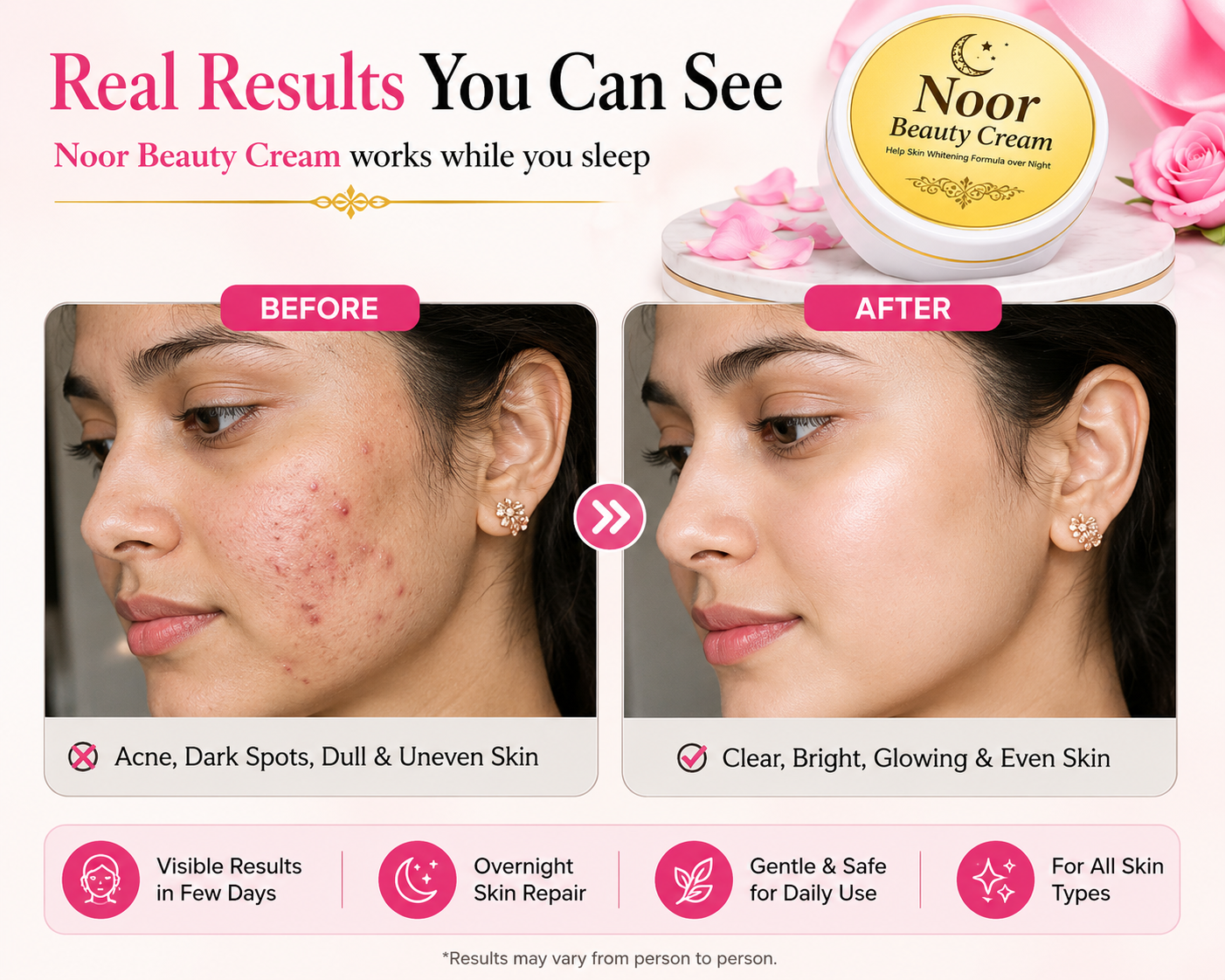 Noor Beauty Cream | Acne Marks & Dark Spots Care